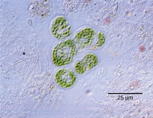 Photo A depicts round colonies of blue-green algae. Each algae cell is about 5 microns across.