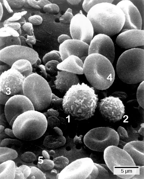 Micrograph shows a blood smear. Red blood cells are disk-shaped, and pinched together in the center. Monocytes, lymphocytes and neutrophils are all ball-shaped and fuzzy. Platelets are small, flat disks.
