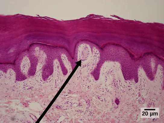 Micrograph shows the epidermis, which stains dark pink and the dermis, which stains light pink. Finger-like projections of epidermis extend into the dermis. Between two of these fingers is an oval Meissner corpuscle about ten microns across and 20 microns long.