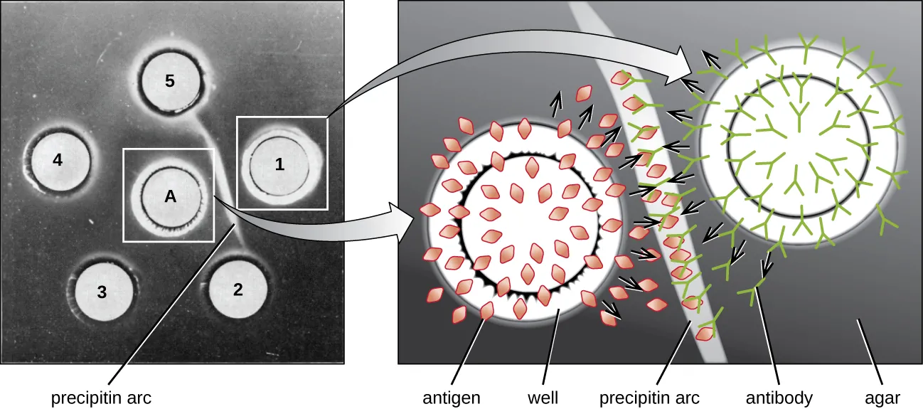 A gel with a central circle labeled A and 5 outer circles numbered 1-5. Between A and 1 is a white band labeled precipitin band. This zone is magnified and a diagram shows that circle A contains antigens in a well. Circle 1 contains antibodies in a well. The antigens and antibodies diffuses outward and meet in the region of the precipitin band. Here they bind together.