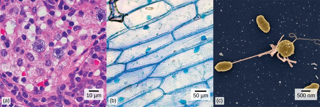 Left: Human nasal sinus cells as viewed by light microscopy have an irregular round shape and a well-defined nucleus that takes up about one-half of the cell. Middle: Onion skin cells, also viewed by light microscopy, are long and thin with a rectangular shape defined by a cell wall. They are about as wide as a nasal sinus cell, but at least five times as long. The cell wall and nucleus are well defined in the micrograph. The onion skin nucleus is about the same size as the nasal sinus cell nucleus. Right: In this scanning electron micrograph of bacterial cells, the cell surface has a three-dimensional shape. Three of the bacteria are oval in shape. The fourth is round and has protrusions called pili. One pilus connects this bacterium to another.