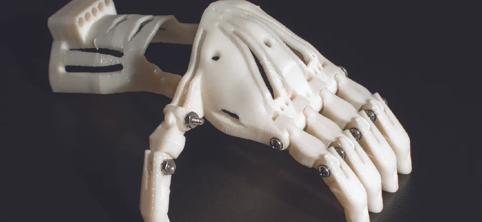 A photo of a prosthetic hand created by a 3D printer.