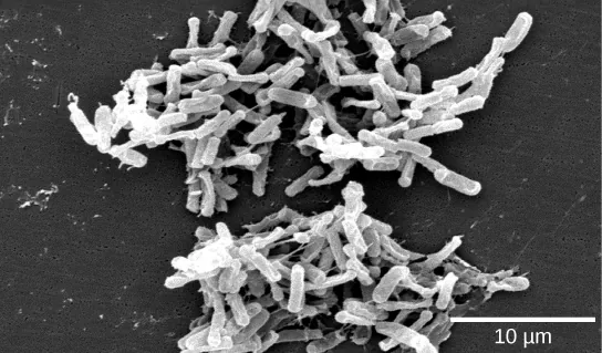 Micrograph shows small clusters of white rod-shaped bacteria against a dark background.