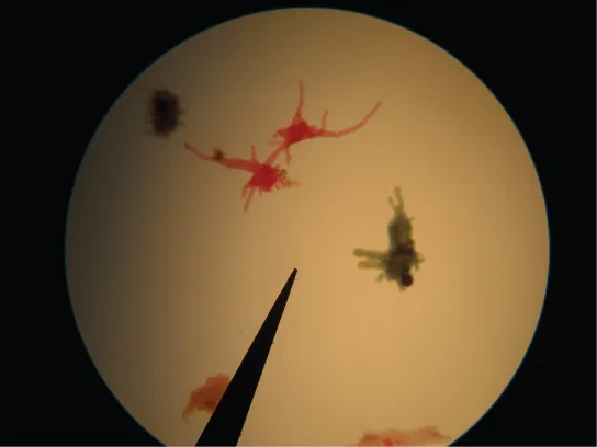 The micrograph shows amoebas with lobe-like pseudopodia.
