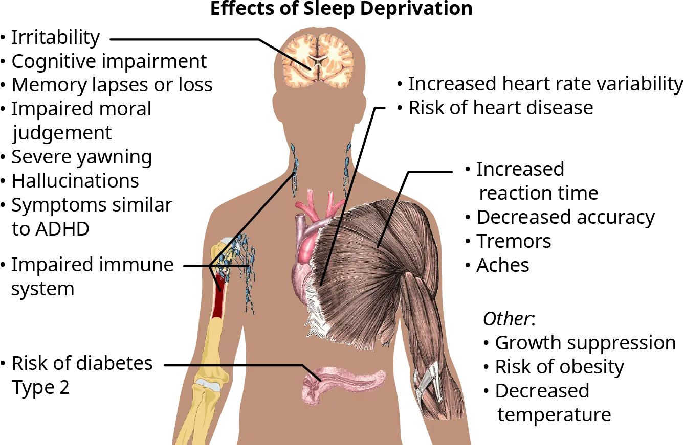 A diagram illustrates the effects of sleep deprivation and the body parts that are affected due to sleep deprivation.