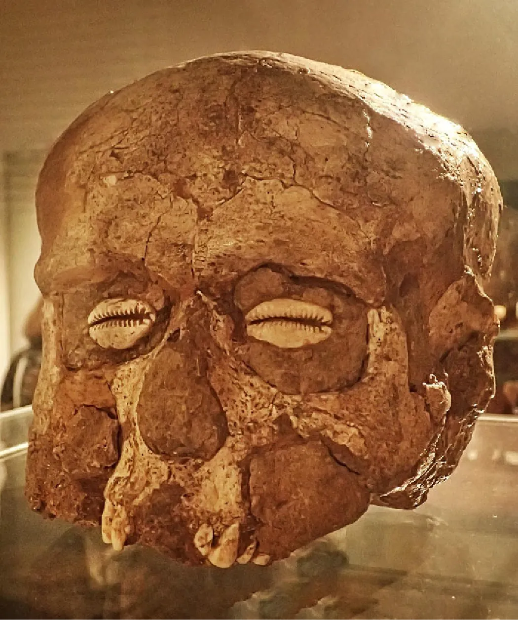 A picture of a brown, cracked skull on a glass surface is shown. Beige walls can be seen in the background. The top of the skull is in one piece, but cracks show all over. Almond shaped beige shells show in the eye sockets. Brownish-beige clay is shown in the nose hole, cheeks, ear holes, as well as in the top part of the jaw. Six teeth are showing in the upper half of the skull. No bottom jaw is shown.