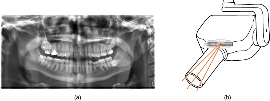 Figura (a) jest zdjęciem rentgenowskim szczęki ludzkiej. Figura (b) przedstawia aparat rentgenowski używany w gabinecie dentystycznym.