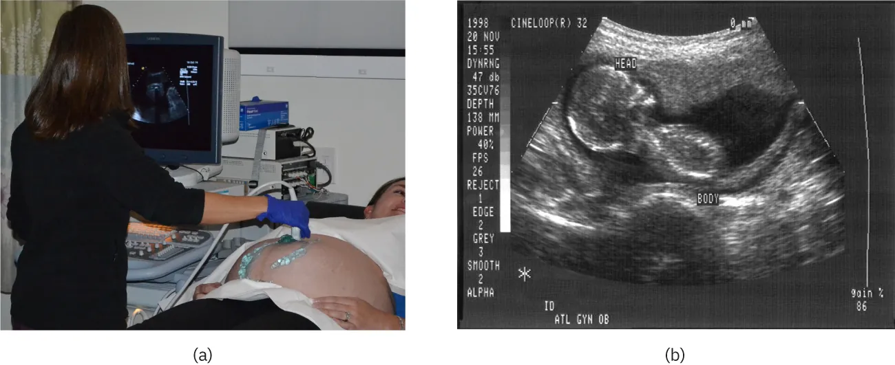 The first part of the diagram shows an ultrasound device scanning a woman’s abdomen. The second part of the diagram is an ultrasound scan report of the abdomen.
