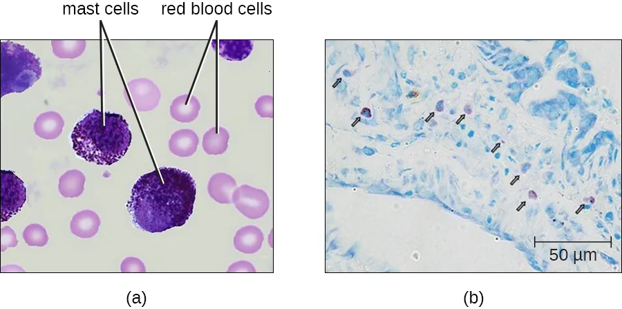 a) Mast cells in blood. Mast cells are large purple cells, red blood cells are small pink cells with a clear center. b) mast cell outside of blood.