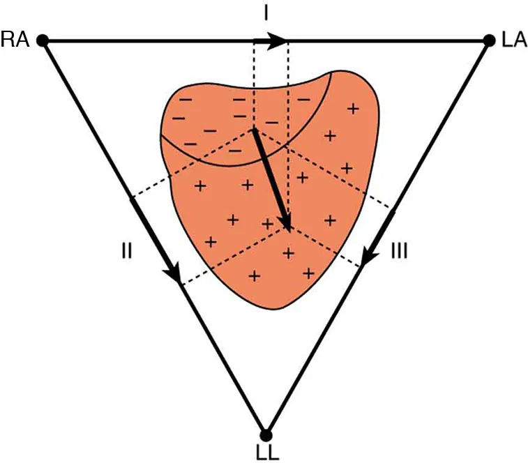 The figure shows that the charge distribution on the outer surface of the heart changes from positive to negative during depolarization. This wave of depolarization, spreading from the upper right toward the lower left of the heart, is represented by a vector pointing in the direction of the wave. The components of this vector are measured by placing electrodes on the patient's chest. The figure shows three electrodes, labeled R A, L A, and L L, placed to form a triangle around the heart. The electrode R A is close to the right atrium, L A is close to the left atrium, and L L is just below the heart. R A and L A form a pair called lead one, R A and L L form a second pair called lead two, and L A and L L form a third pair called lead three. Each pair of electrodes measures a component of the depolarization vector.