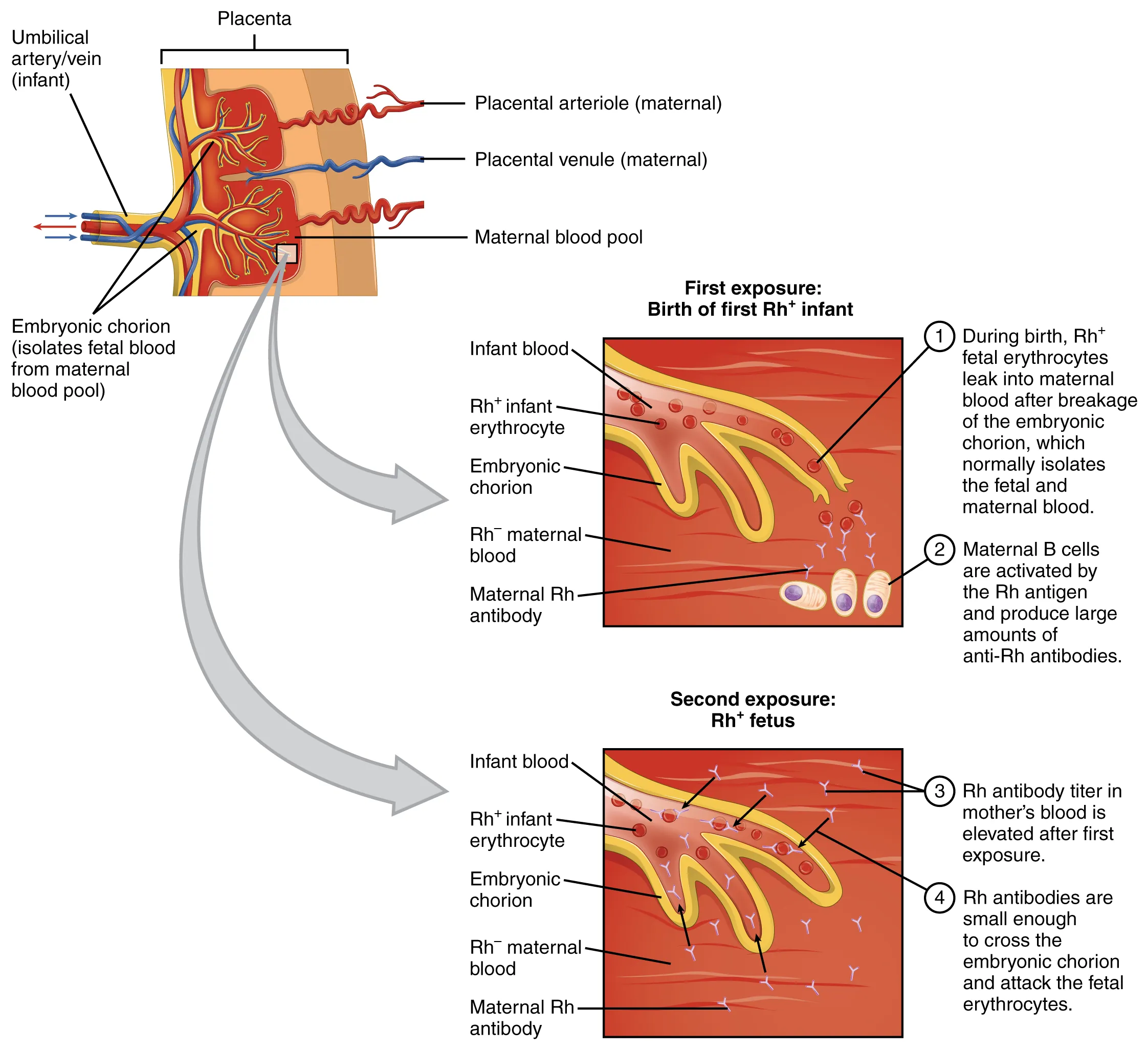 This figure shows an umbilical artery and vein passing through the placenta on the top left. The top right panel shows the first exposure to Rh+ antibodies in the mother. The bottom right panel shows the response when the second exposure in the form of another fetus takes place. Textboxes detail the steps in each process.