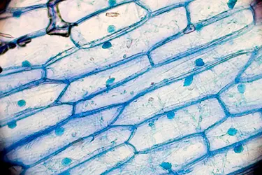 Cell membranes of onion cells, similar in appearance to a section of a brick wall.
