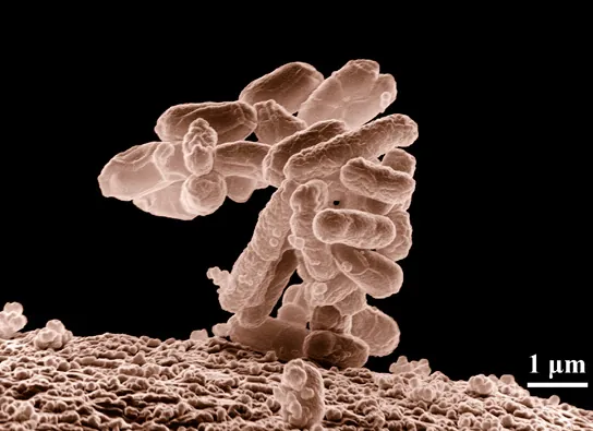 Photo depicts E. coli bacteria aggregated together.