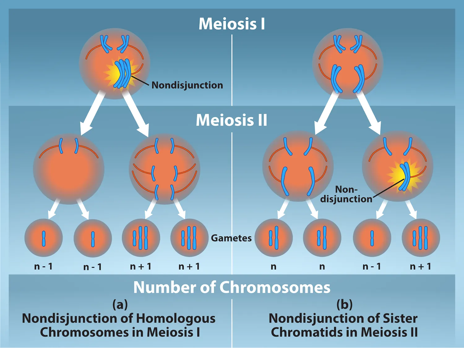 This illustration shows nondisjunction that occurs during meiosis I. Nondisjunction during meiosis I occurs when a homologous pair fails to separate, and results in two gametes with n + 1 chromosomes, and two gametes with n  minus 1 chromosomes. Nondisjunction during meiosis I I would occur when sister chromatids fail to separate, and results in one gamete with n + 1 chromosomes, one gamete with n minus 1 chromosomes, and two normal gametes.