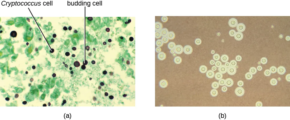a) A micrograph with dark circles (some attached to form a figure 8) on a green background. The dark cells are labeled Cryptococcus. The figure 8 cells are labeled budding cells. b) a negative stain micrograph of cryptococcus neoformans is shown. It appears as green spots on a brown background.