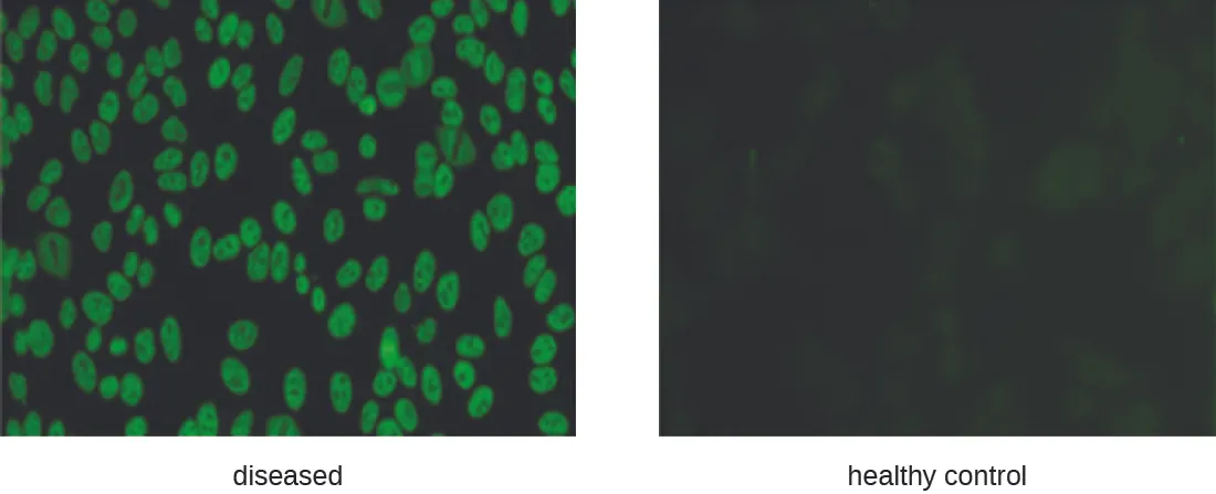 Two micrographs. The diseased sample has glowing green ovals, the healthy control does not.
