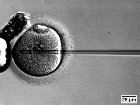 Micrograph shows a needle injecting sperm into an egg.