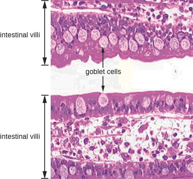 Micrograph of intestinal villi which are 2 pink regions separated by a clear space. The surface of each pink band is darker pink than the center and the surface contains lighter pink oval cells labeled goblet cells.