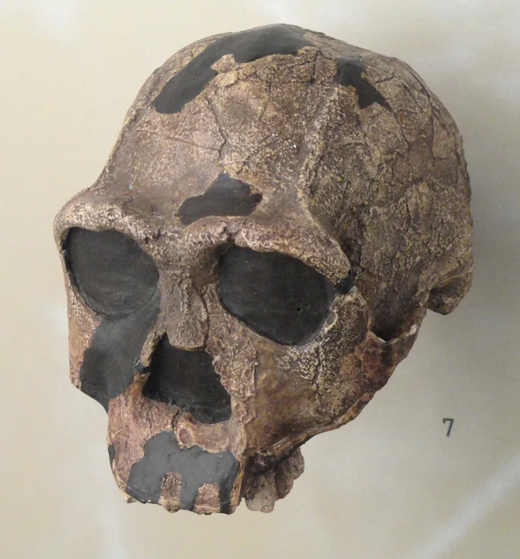 A skull with no lower jaw.
