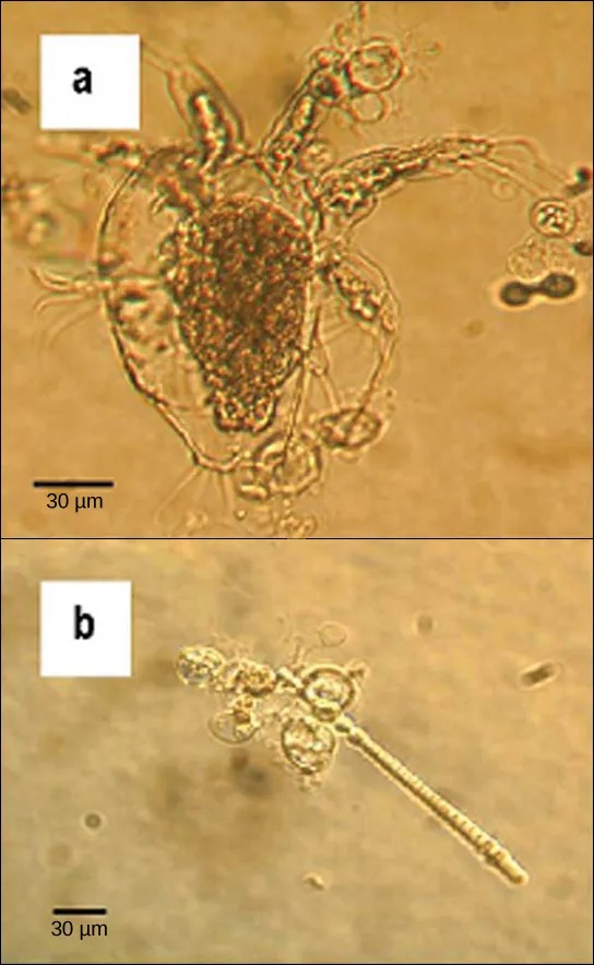 Micrograph A shows an arthropod, which is a teardrop-shaped transparent organism about 90 microns across and 120 microns long. Tentacle-like appendages jut out from the front, wide end of the organism, and clusters of cilia-like appendages just out from either side and the back. Transparent oval organisms about 20 microns across cling to the arthropod. Micrograph B shows a similar oval transparent organisms clinging to rod-shaped algae about 5 microns across and 200 microns long.