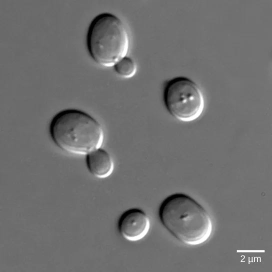 The photo shows yeast cells, some of which have buds protruding from them.