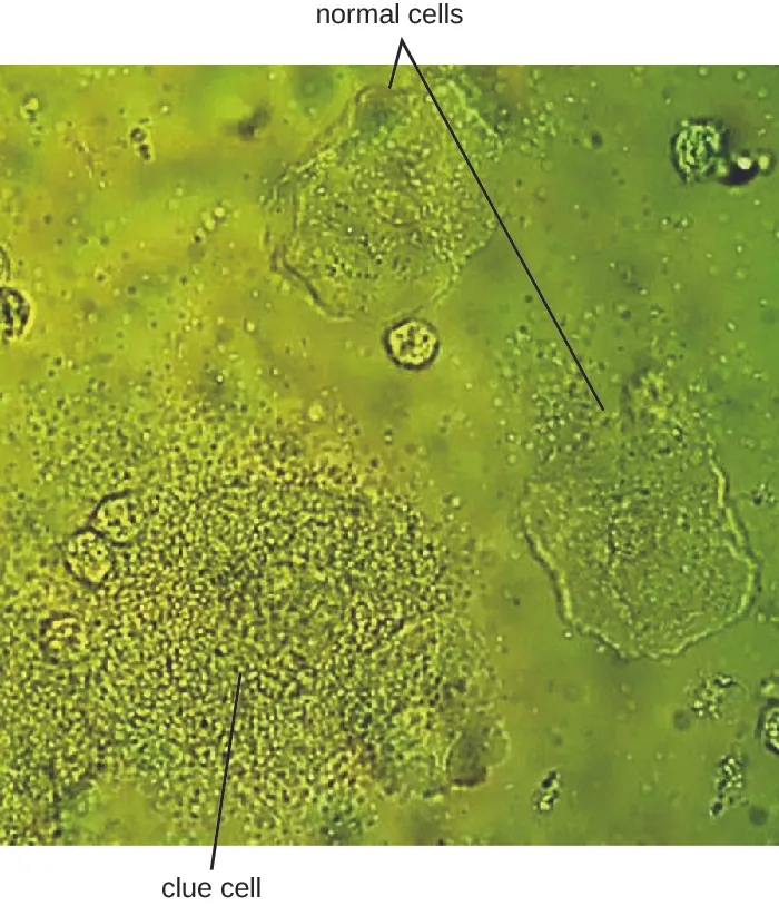 Micrograph of larger human cells and smaller bacterial cells.