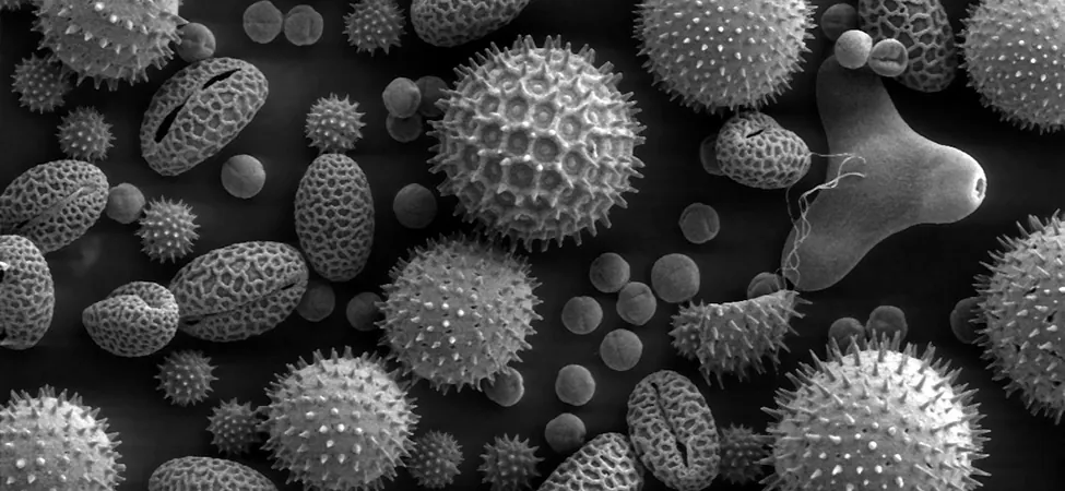 Picture shows a group of pollen molecules. All molecules have either a circular or oval shape. Some molecules have granular morphology, others have numerous spikes sticking out of their surface.