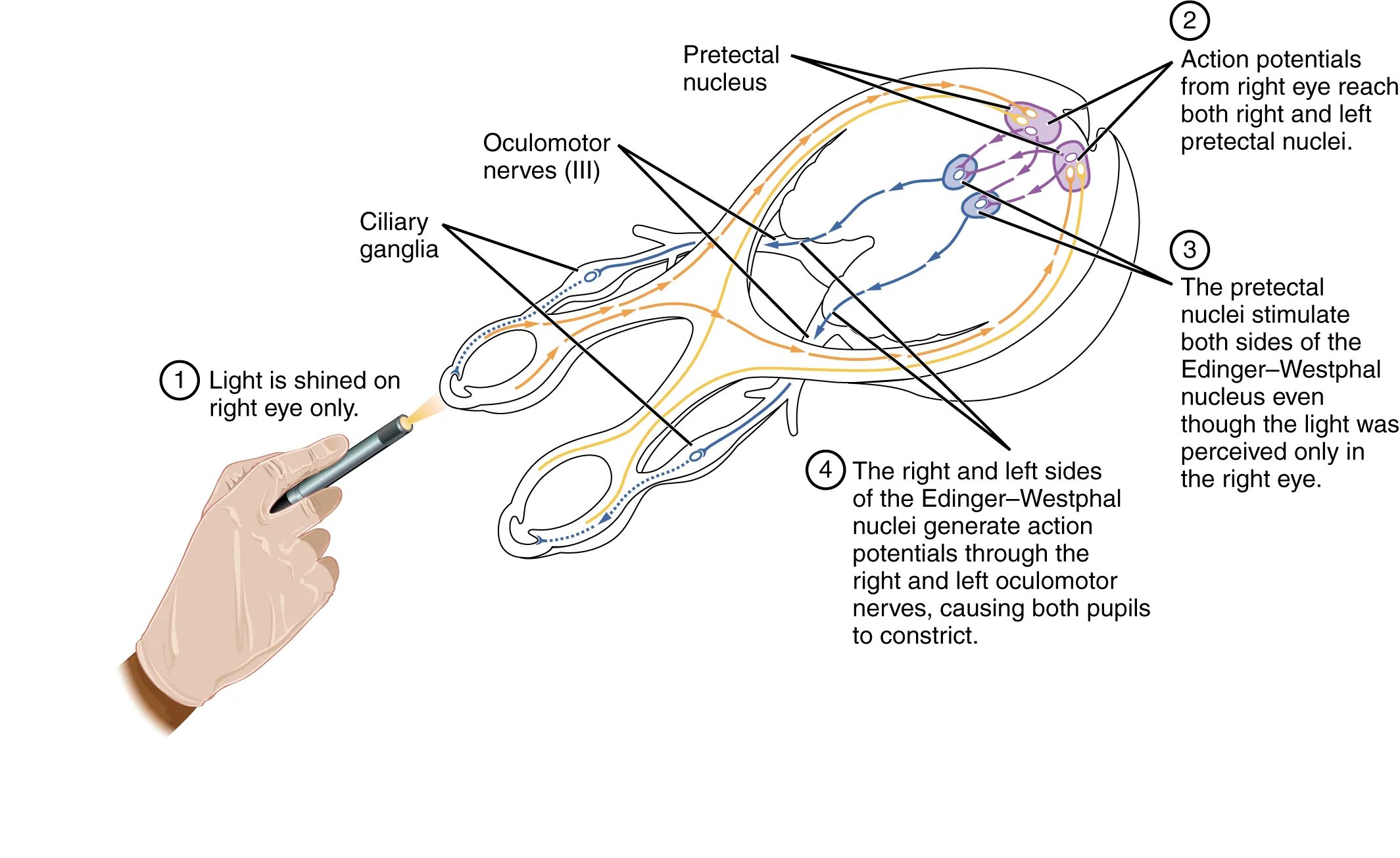 This diagram shows the connections between the different nerves and pathways in the eyes. A hand is shown shining a light on the right eye, and arrows and text callouts indicate the different pathways that are activated.