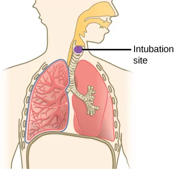 An illustration shows a human torso and lower head with the respiratory system highlighted. The head is turned to the viewer's right. Openings from the nose and mouth represent the nasal and oral cavity and come together to form the pharynx just to the right of the midline of the head. There they extend downward and branch to a short, thick piece extending to the lower right and a long thin piece extending to the lower left behind the lungs. The thick piece has a flat base where it joins the larynx, a short, wide, flattened region at the top of the trachea that contains an oval labeled intubation site. The trachea is a thick tube encircled by concentric horizontal ring-like grooves along its length. The trachea extends down between the left and right lungs before branching into two primary bronchi, which each have similar concentric patterns. The primary bronchus that extends to the viewer's left is hidden within the lung to the viewer's left, which contains many wide tubes that branch into smaller tubes that branch into even smaller tubes. The larger tubes represent secondary bronchi that branch into smaller tertiary bronchi that branch into even smaller bronchioles that branch into terminal bronchioles. All of these smaller tubes lack concentric patterns. The primary bronchus that extends to the lung on the viewer's right is shown branching into a clump of tubes that extend outward in all directions to form a roughly oval structure. There is a space between the lungs beneath the split of the trachea into the primary bronchi. The outer boundaries of the lungs are each covered by a layer of small ovals that lie lengthwise against the lung with a wavy line on their outer boundary. A solid line representing the diaphragm extends up on the viewer's left to run along the bottoms of both lungs before bending down on the viewer's right.