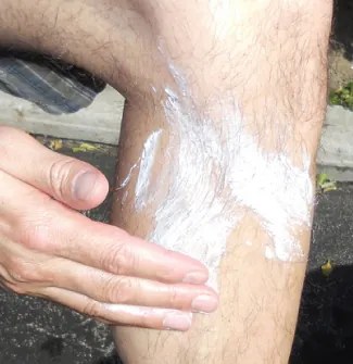 Una fotografía muestra la mano de una persona mientras se aplica una crema blanca en la pierna.