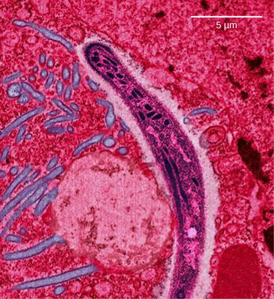 Photo b shows a micrograph of sickle-shaped Plasmodium falciparum, the parasite that causes malaria. The Plasmodium is about 0.75 microns across.