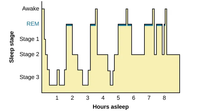 This is a hypnogram showing the transitions of the sleep cycle during a typical eight hour period of sleep. During the first hour, the person goes through stages 1 and 2 and ends at 3. In the second hour, sleep oscillates in stage 3 before attaining a 30-minute period of REM sleep. The third hour follows the same pattern as the second, but ends with a brief awake period. The fourth hour follows a similar pattern as the third, with a slightly longer REM stage. In the fifth hour, stage 3 is no longer reached. The sleep stages are fluctuating from 2, to 1, to REM, to awake, and then they repeat with shortening intervals until the end of the eighth hour when the person awakens.