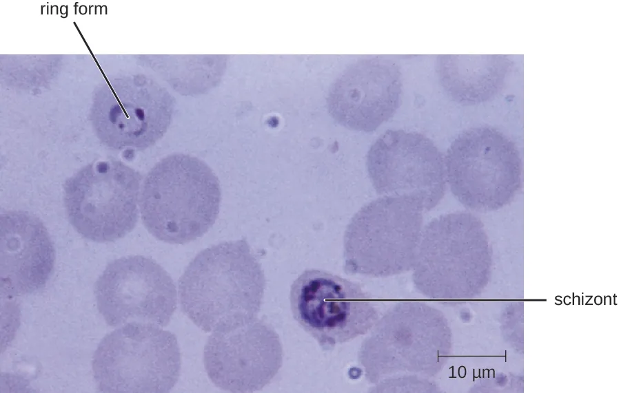 A micrograph showing red blood cells. A dark ring in the center of one cell is labeled ring form. A larger dark region in another cell is labeled schizont.
