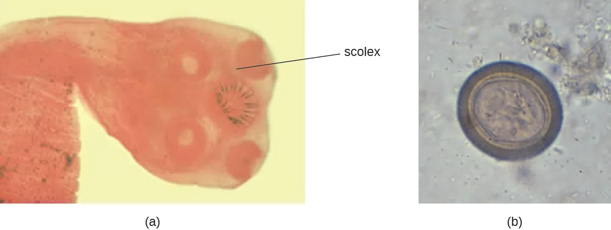 a) a micrograph of a worm with a round end labeled scolex. The scolex has round structures that look like suckers. B) micrograph of an oval cell with a thick wall.