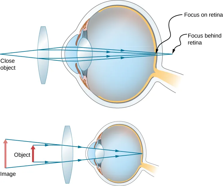 Figure shows two eyes with a bi-convex lens in front of each. The first one shows rays from a close object striking the lens and deviating towards each other before striking the cornea. They then converge on the retina. The second one shows an object close to the lens and an upright, larger image farther away from the lens.
