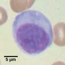 Micrograph shows a round cell with a large nucleus.