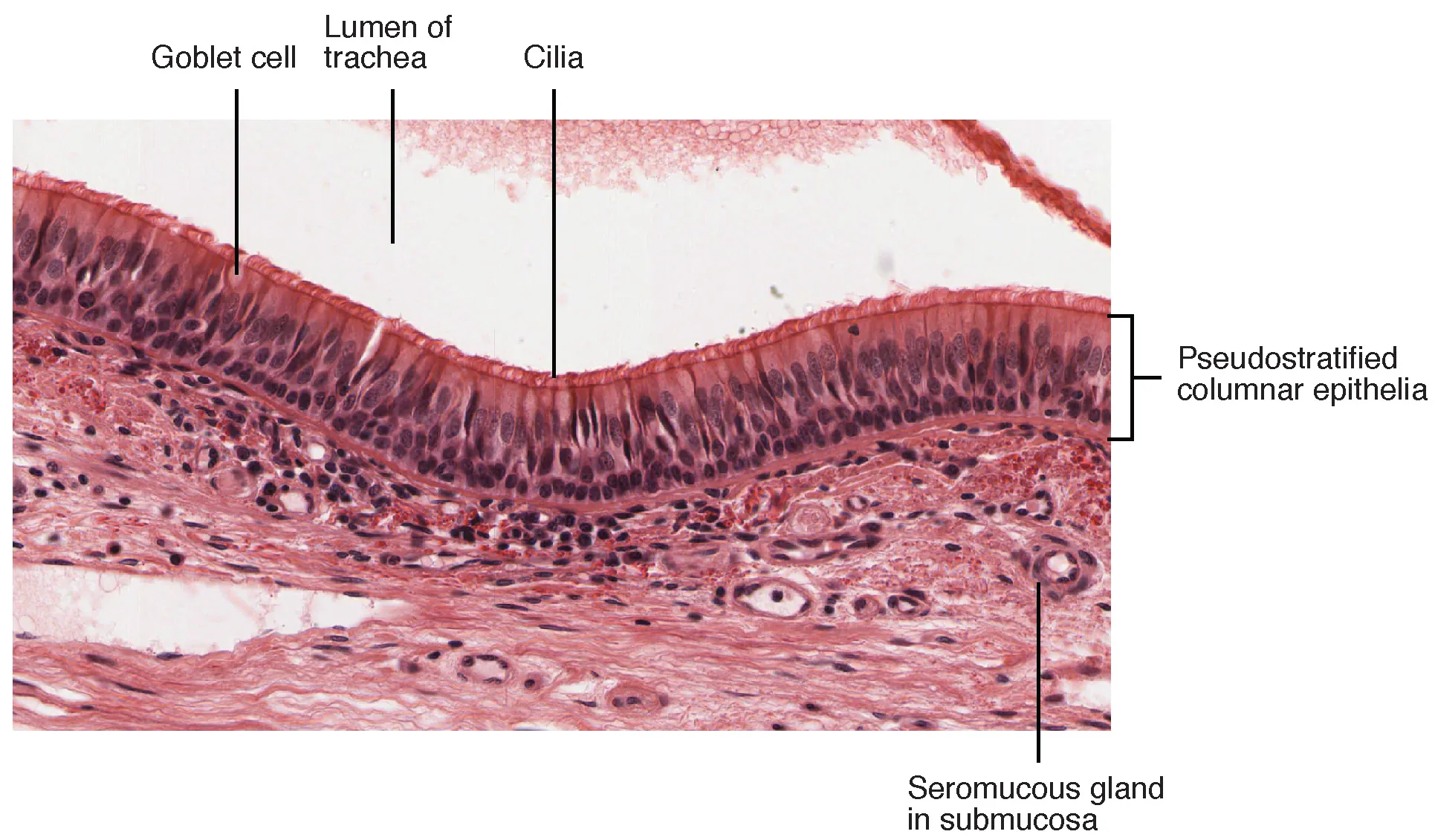 This figure shows a micrograph of pseudostratified epithelium.