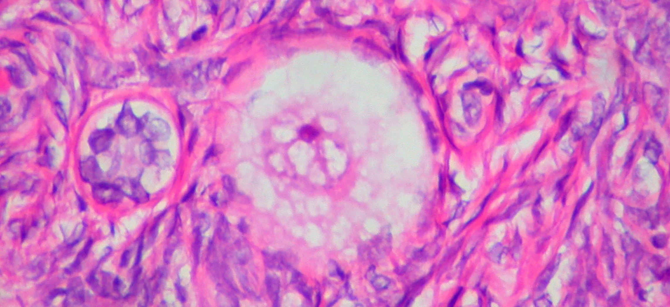 This photo shows an oocyte.