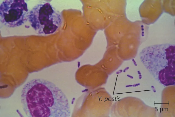 A micrograph showing small rod shaped purple cells in between larger human cells. The purple bacterial cells have a small clear circle in the center.