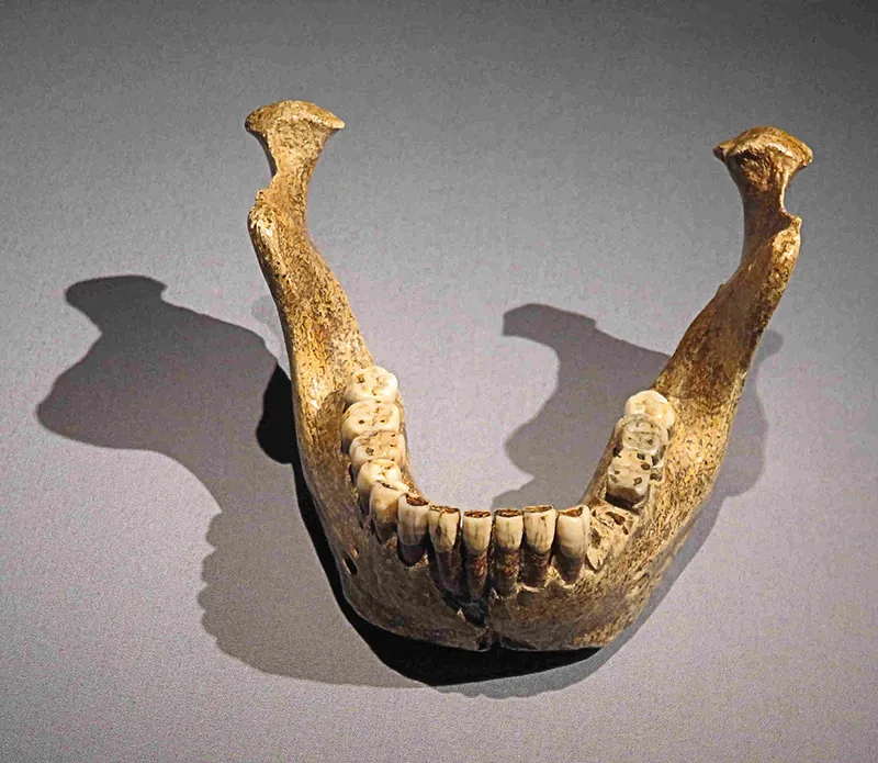 Jawbone detached from the skull.