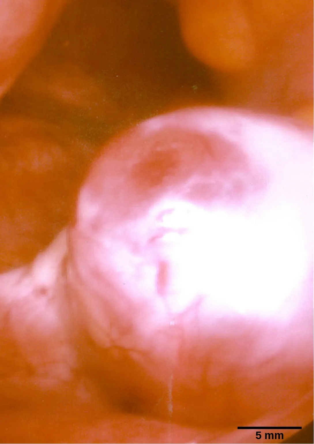  Micrograph shows a spherical egg growing on the surface of a tissue.