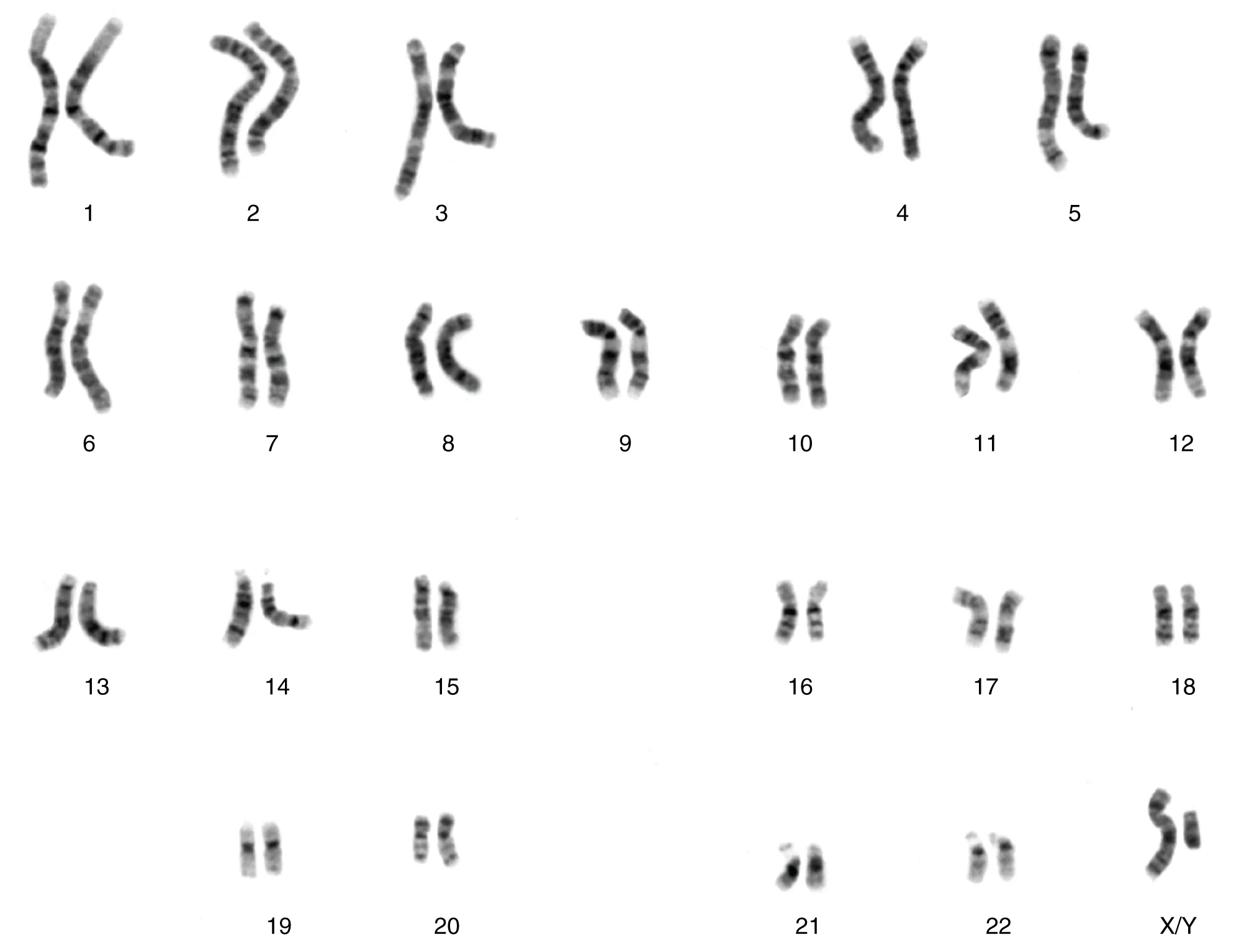 This figure show the 23 pairs of chromosomes in a male human being.