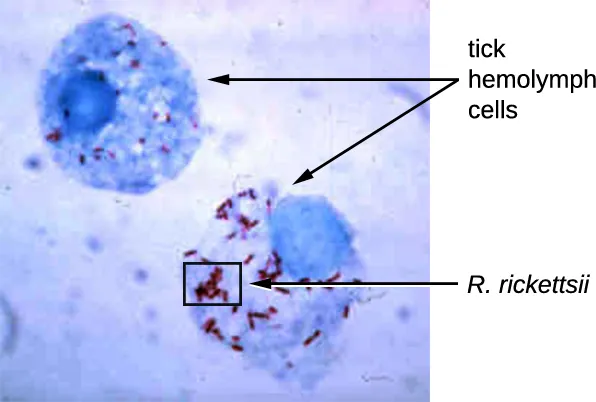 A micrograph of blue cells labeled tick hemolymph cells. Inside of these cells are small red cells labeled R. rickettsia.