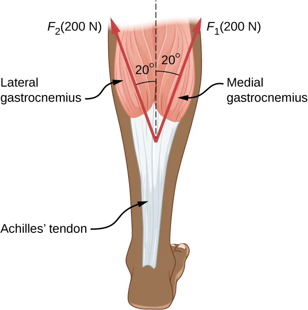 An Achilles tendon is shown in the figure. A vertical dotted line is shown at the middle of the top part. Two vectors inclined at twenty degree each with respect to the vertical dotted line are shown.