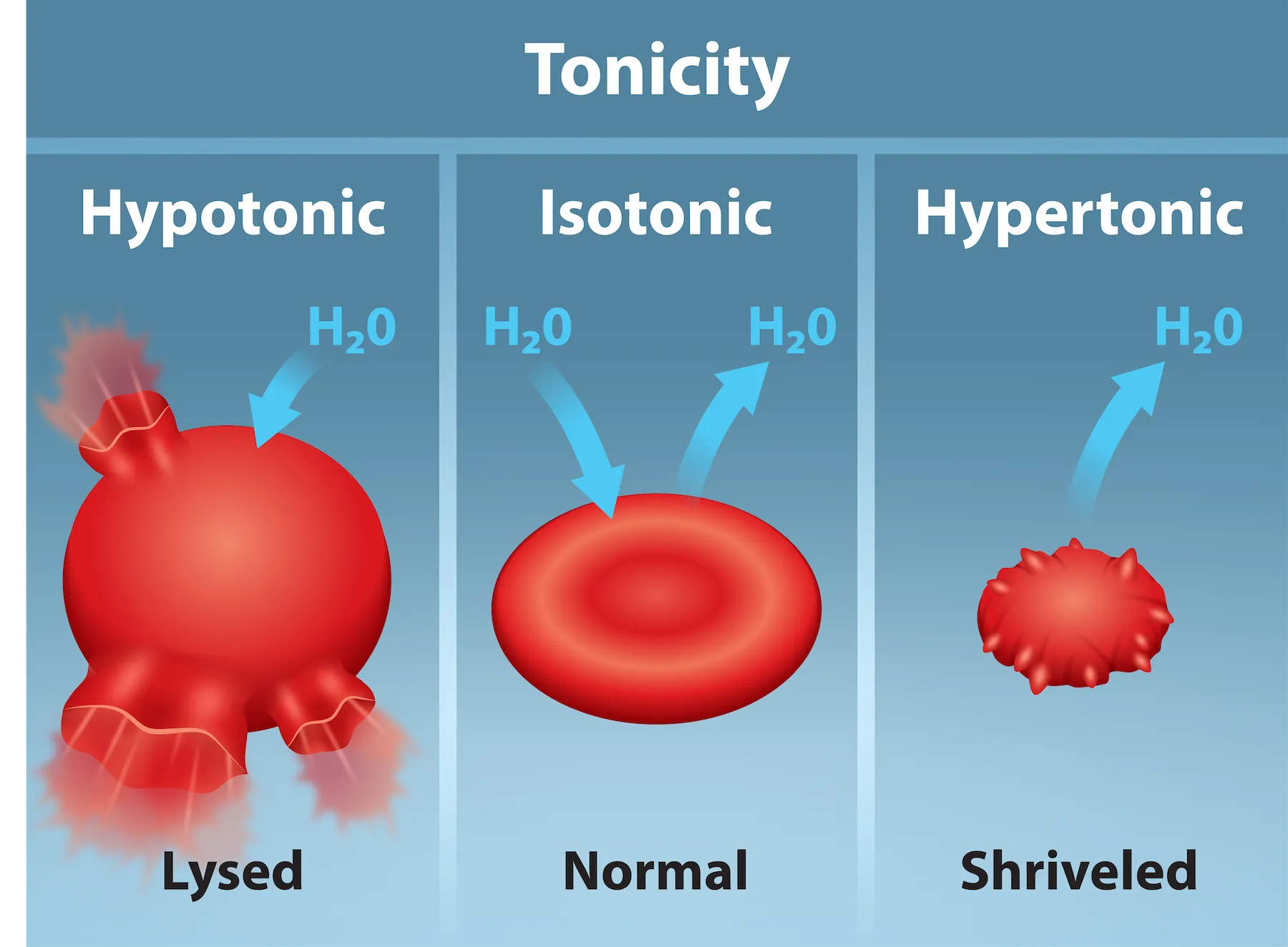 The left part of this illustration shows shriveled red blood cells bathed in a hypertonic solution. The middle part shows healthy red blood cells bathed in an isotonic solution, and the right part shows bloated red blood cells bathed in a hypotonic solution.