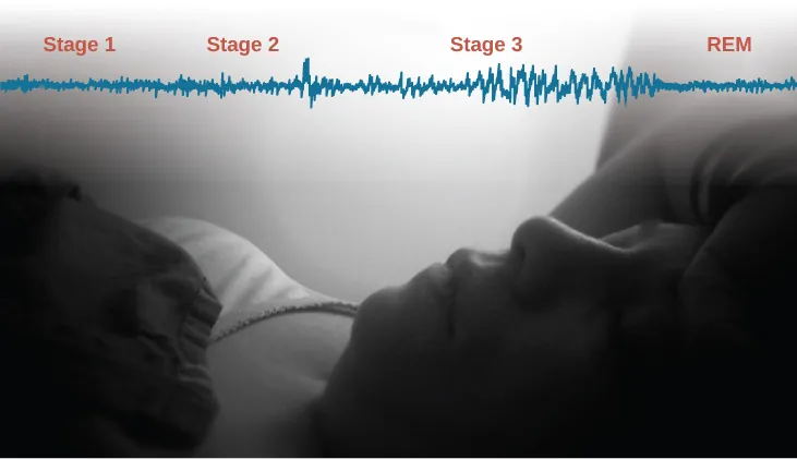 A photograph shows a person sleeping. Superimposed across the top of the picture is a line representing brainwave activity across the four stages of sleep. Above the line, from left to right, it reads stage 1, stage 2, stage 3, and REM. The wave amplitude is highest in late stage 2, and in the middle of stage 3 until REM. The wavelength is longer from late stage 2 through stage 3.