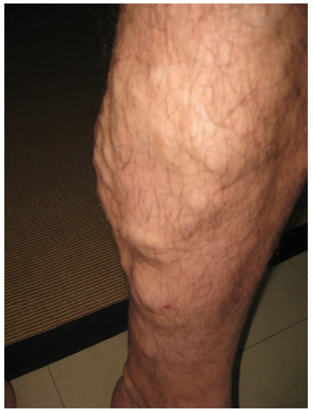 This photo shows a person’s leg.