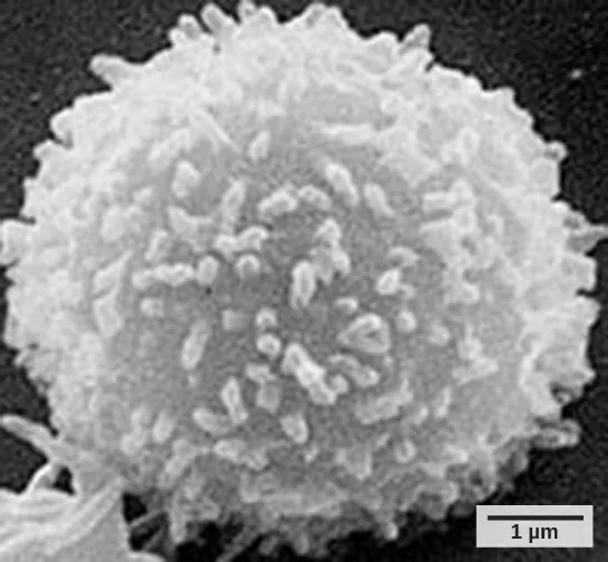 Micrograph shows a cell that looks like a fuzzy snowball.