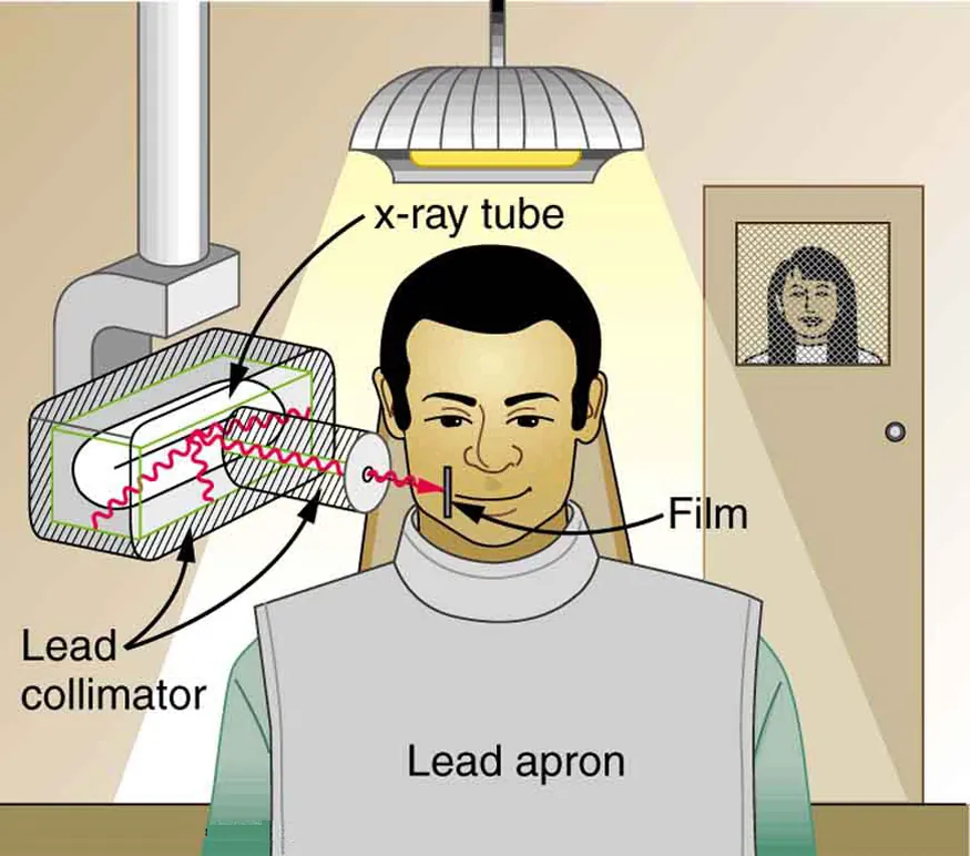 The image shows a dental patient wearing a lead apron sitting in a chair. X-rays emitting from an x-ray tube that is placed on the side of the patient's jaw are passing through only the affected area of his teeth.