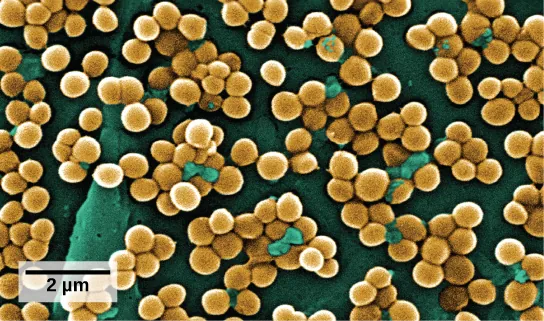 The scanning electron micrograph shows clusters of round bacteria, clinging to a surface.